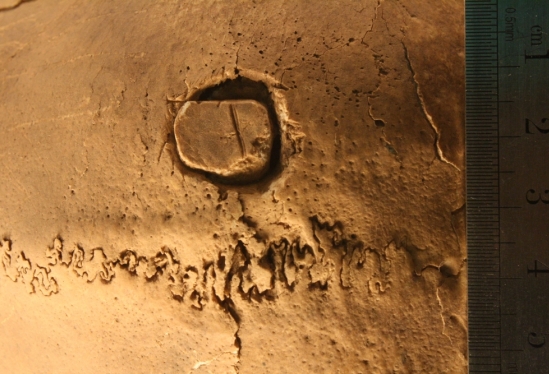 Kurin-Trepanation8.jpg