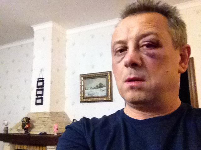 Під Києвом жорстоко побили депутата Володимира Курінного