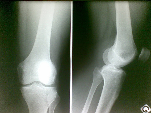 2343141506_9f09b7a1ef_z