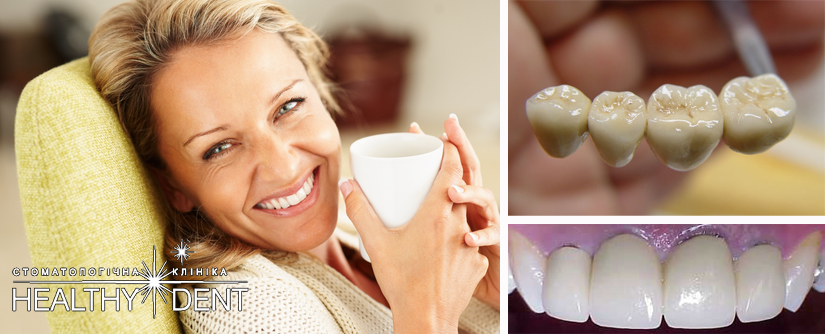 metallokeramicheskie_koronky