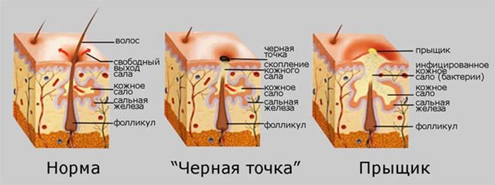 черная точка