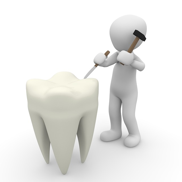 tooth-1015409_640