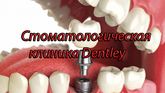 протезирование зубов