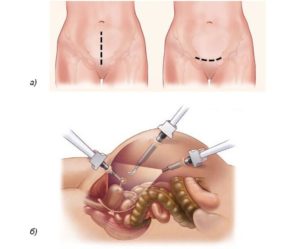 173d8a656dc89ac29e3a56e01edeea60-300x249