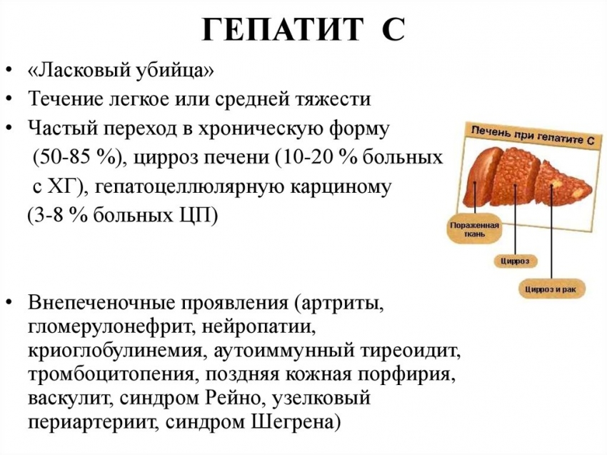 гепатит с
