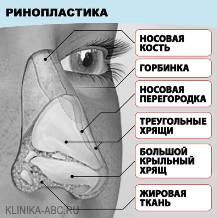 Горбинка на носу: откуда она берётся и можно ли от неё избавиться?
