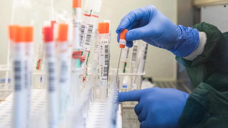 urn-newsml-dpa-com-20090101-201103-99-197600_large_4_3_eine_mitarbeiterin_eines_labors_ueberfuehrt_einen_trockenen_-800x450