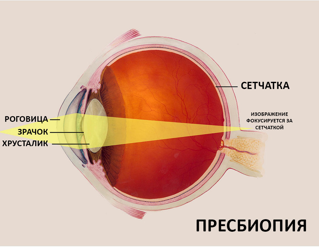 Как справиться с возрастными изменениями зрения?