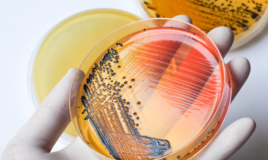 id5177882-petri-dish-salmonella-min-870x522
